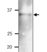 PBP1 | PYK10-binding protein 1 (C-terminal) in the group Antibodies Plant/Algal / Environmental Stress / Pathogen attack at Agrisera AB (Antibodies for research) (AS20 4413)